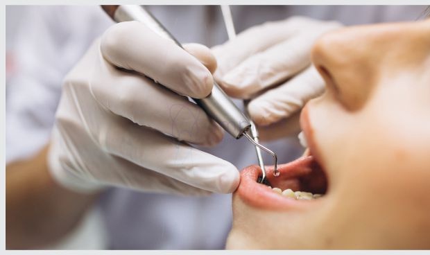 periodonto