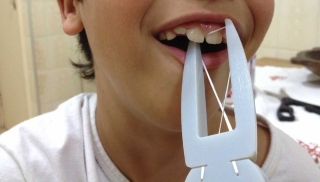 Dentista de Cuiabá cria aparelho fixador e passador de fio dental para pacientes com deficiência